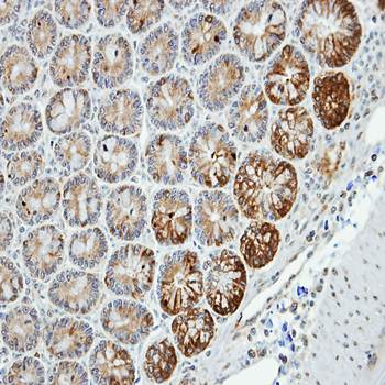 MST4 antibody
