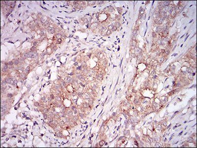 MSTN Antibody