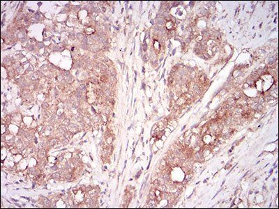 MSTN Antibody