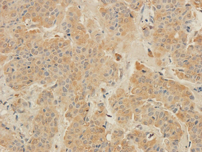 MT-ATP8 antibody