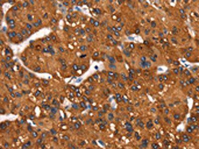 MT-CYB Antibody