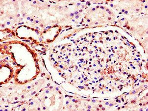 MT-ND1 Antibody
