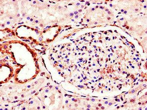 MT-ND1 antibody