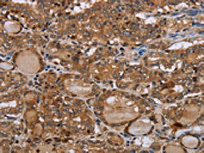 MT-ND1 Antibody
