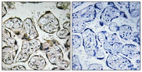 MT-ND1 Antibody