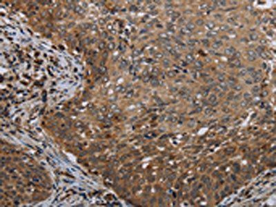 MT-ND6 Antibody