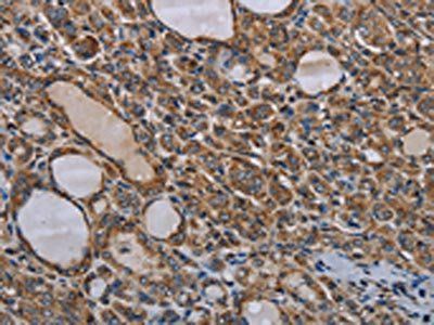 MT-ND6 Antibody