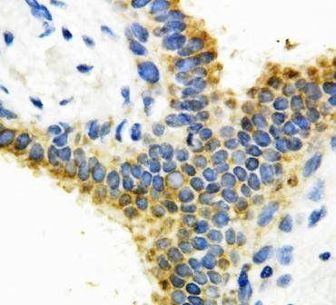 MTA1 Rabbit Polyclonal Antibody