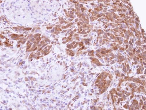 MTAP antibody [N1C3]