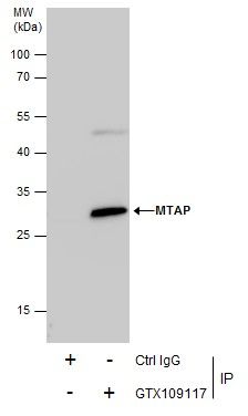 MTAP antibody [N1C3]
