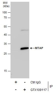 MTAP antibody