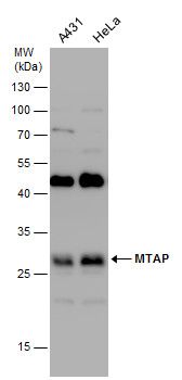MTAP antibody