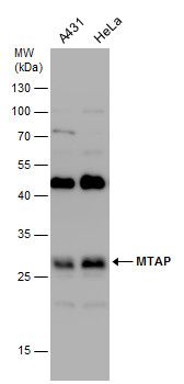 MTAP antibody [N1C3]