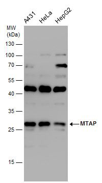 MTAP antibody