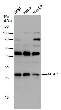 MTAP antibody [N1C3]