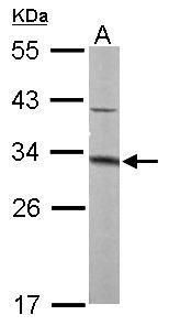 MTAP antibody [N1C3]