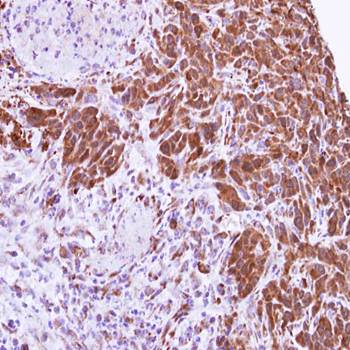 MTAP antibody