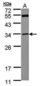 MTAP antibody
