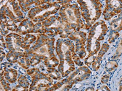 MTCH2 Antibody