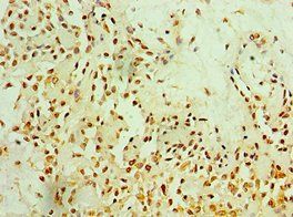MTDH Antibody