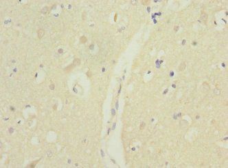 MTERF3 Antibody