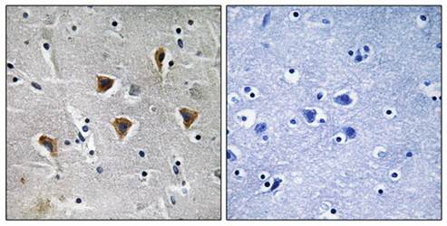 MTERF Antibody