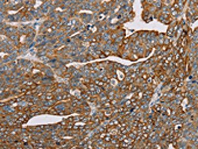 MTFP1 Antibody