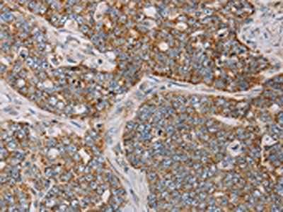 MTFP1 Antibody