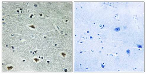 MTG16 Antibody