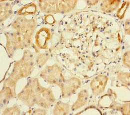 MTHFD2 Antibody