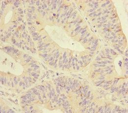 MTHFD2 Antibody