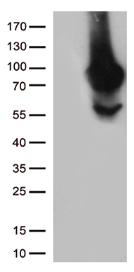 MTHFR Antibody