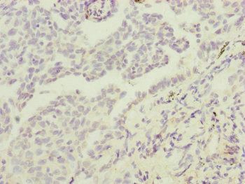 MTIF3 Antibody