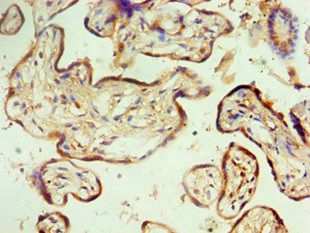 MTMR14 Antibody