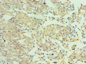 MTMR4 Antibody