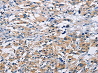 MTMR4 Antibody
