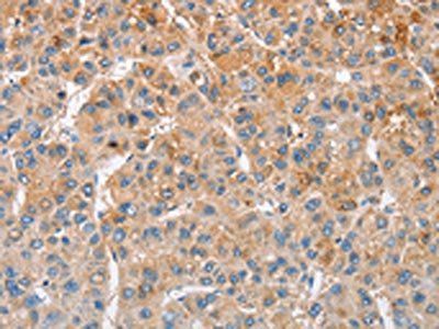 MTMR4 Antibody