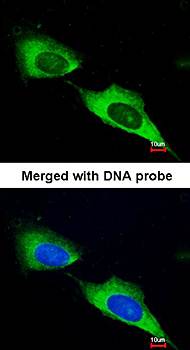 MTMR9 antibody