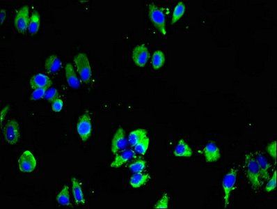 MTNR1B antibody