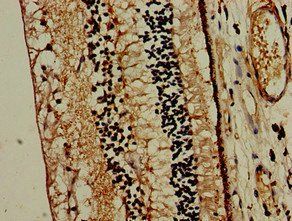 MTNR1B Antibody