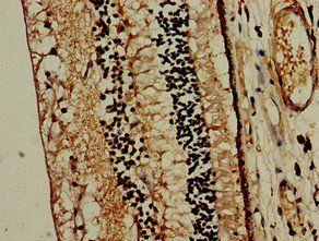 MTNR1B antibody