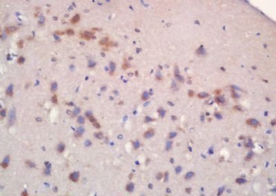 mTOR (phospho-Ser2481) antibody