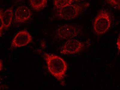 mTOR (Phospho-Ser2448) Antibody