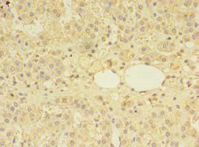 MTR Antibody
