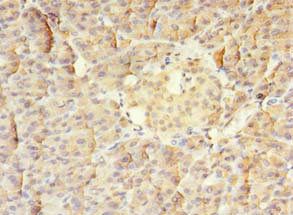 MTR Antibody