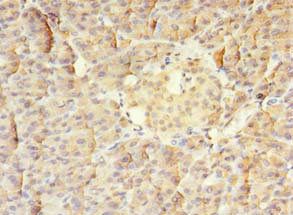 MTR antibody