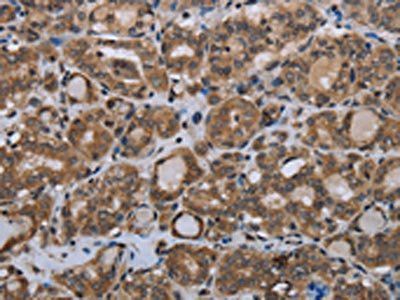 MTSS1 Antibody
