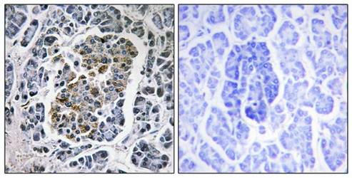 MtSSB Antibody