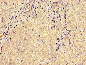 MTTP antibody