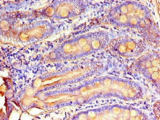 MTTP Antibody